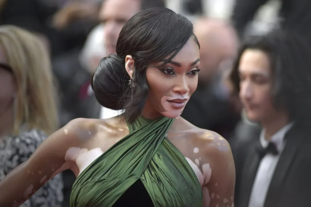 Sources of Income of Winnie Harlow Net Worth