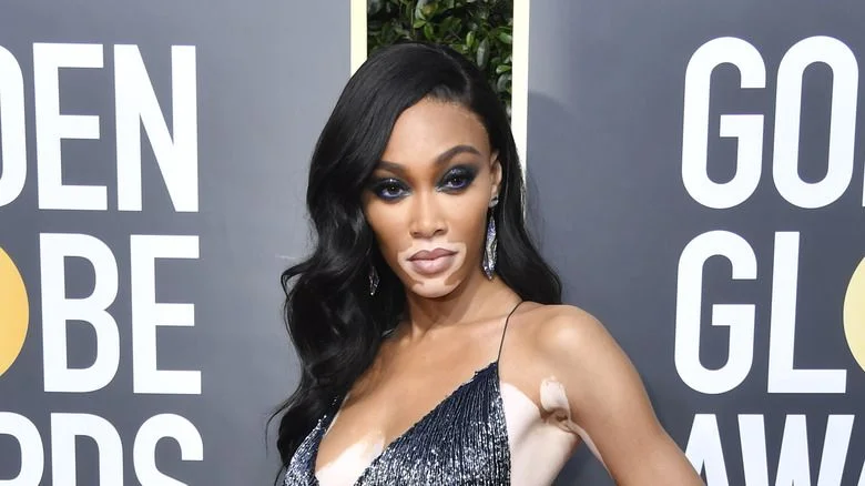 Real Estate and Assets of Winnie Harlow Net Worth